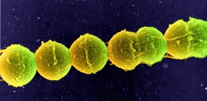 Streptococcus bacteria, pictured here, can linger on musical instruments for days, researchers recently found.