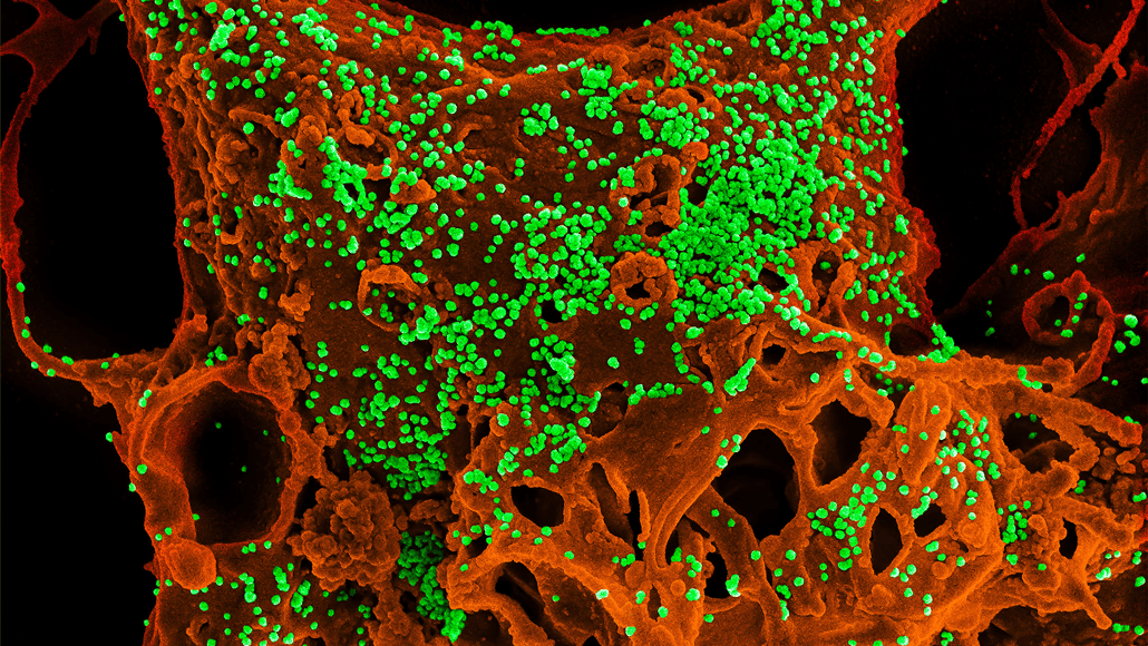 coronvirus micrograph