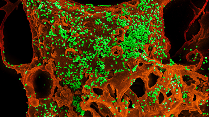 coronvirus micrograph