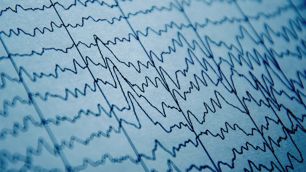 Scientists Say: Brainwaves
