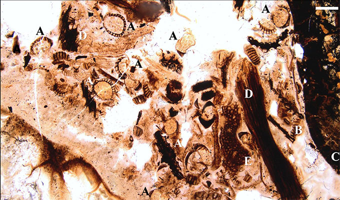 a photo of a slide of stomach contents