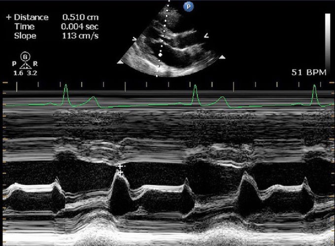 an echocardiogram of an ape's heart