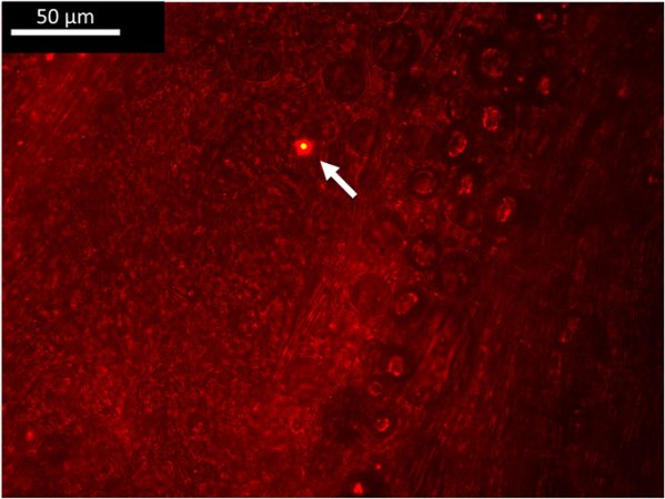 a nano-sized piece of plastic inside amphipod