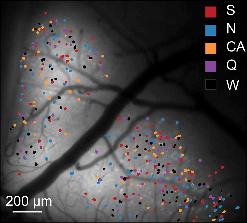 an image of a mouse's taste center in the brain, with many different colored dots scattered across the image