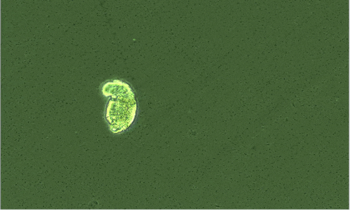 a rotifer stretches and attaches to the bottom of a slide, trying to get out of the field of vision