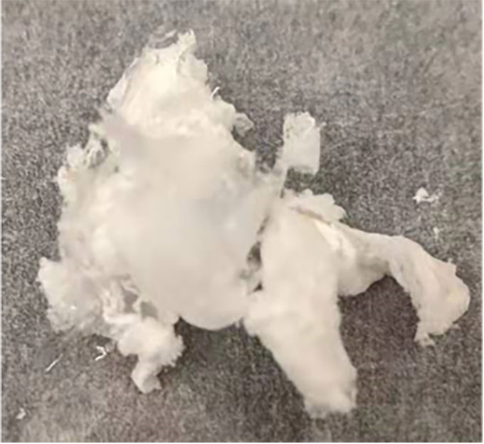 a microscopic image of an artificially designed protein