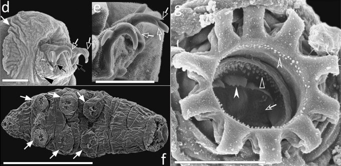 a composite of several electron microscope images of the mouth and sharp claws of a tardigrade