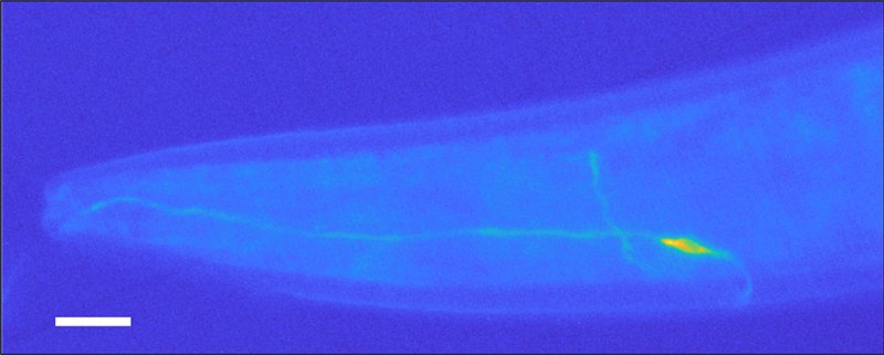 an image showing a glowing neuron in a C. elegans worm