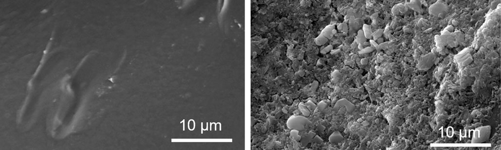 a composite of two microscipic images, one showing plastic before exposure to the plastic eating bacteria, and one after (smooth versus very bumpy and textured)