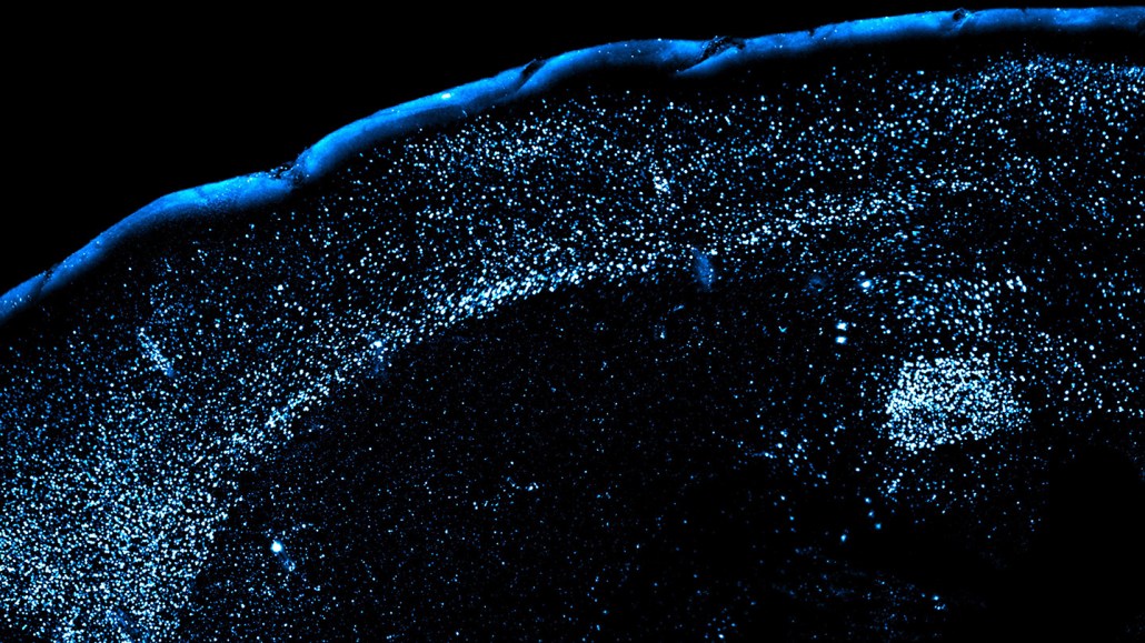 Mouse brain region called the amygdala shown in blue after it encountered an unknown food or experienced symptoms of food poisoning