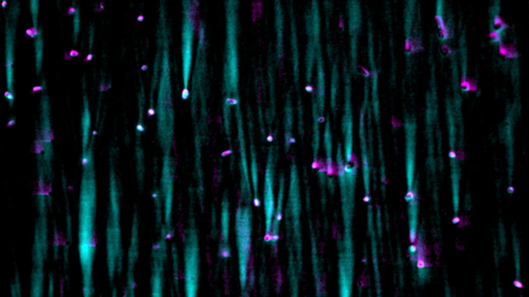 purple dots (bacterial microlenses) are seen at the ends of teal streaks (jets of focused light)