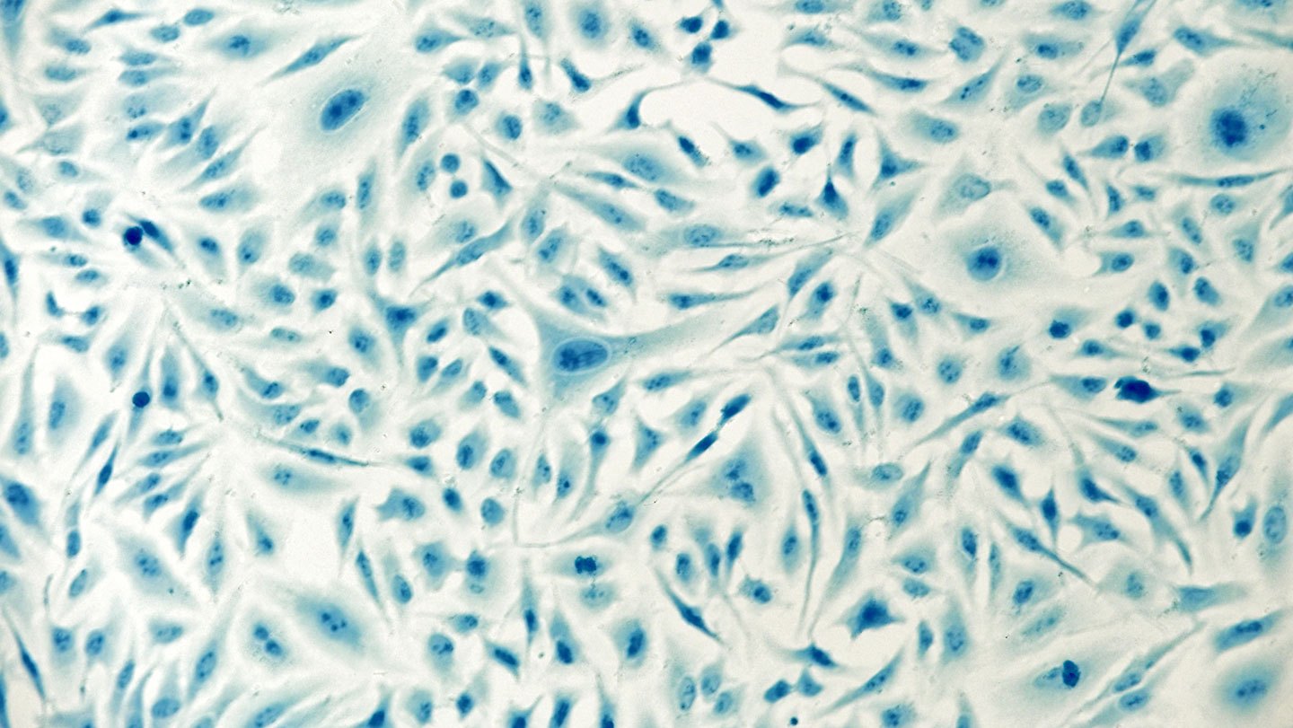 Pattern Inside Cell Scientists shrink 3-D printing so it can work inside cells