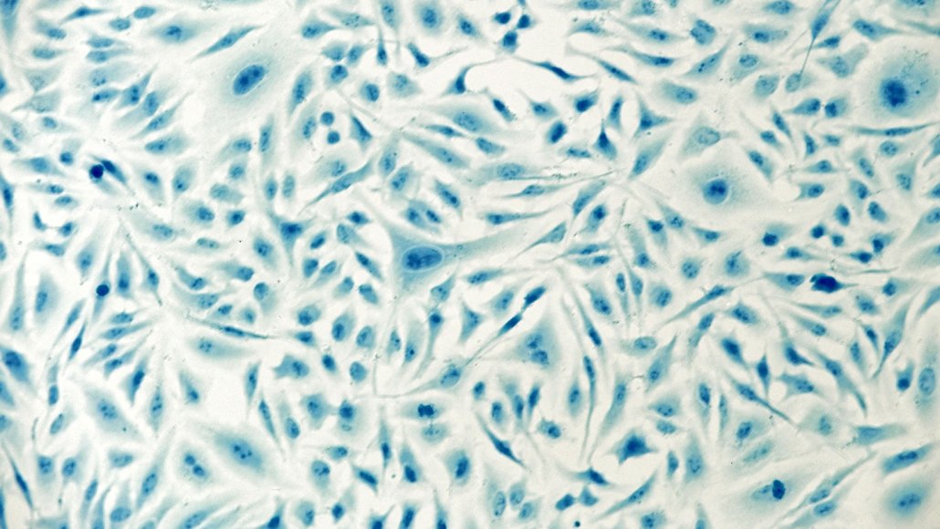 Cells appear as splotches in varying shades of blue.