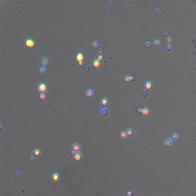 a microscopic image of osteoyeast cells (oval blobs) with dye to show where calcium and phosphate molecules are present
