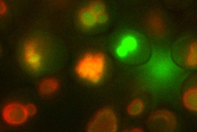 a microscopic photo of osteoyeast cells (round blobs) glowing red, green and orange