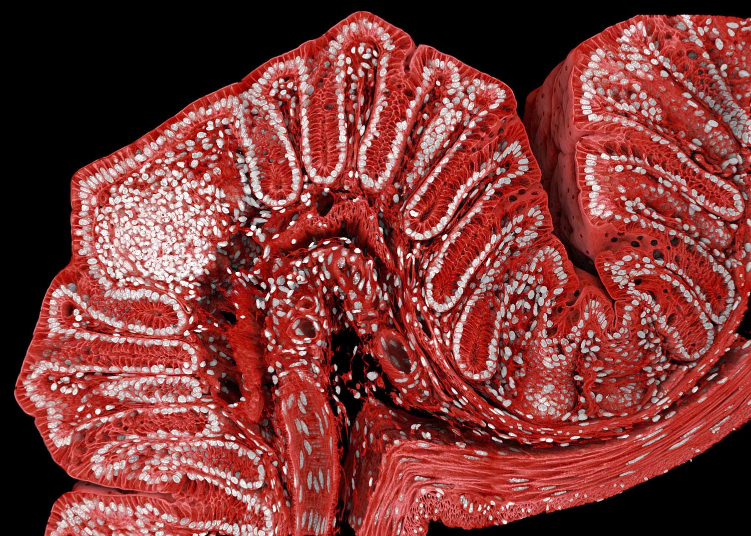 A cross section of a mouse colon shows what looks like a worm shaped tube. Inside the tube there are folds. Small white dots run along the folds in a serpentine pattern.