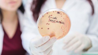 an agar plate showing bacterial cultures held by a person in a white coat and wearing sterile gloves