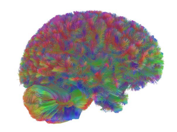 a computer generated image showing connections between brain cells as a color map