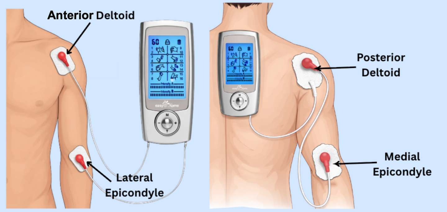 Diagram showing TENS/EMS electrode placement on a male torso for shoulder and elbow treatment. The left panel shows the front of the body with electrodes on the Anterior Deltoid and Lateral Epicondyle. The right panel shows the back of the body with electrodes on the Posterior Deltoid and Medial Epicondyle. Both panels show a handheld EMS device connected to the electrode pads via white cables.