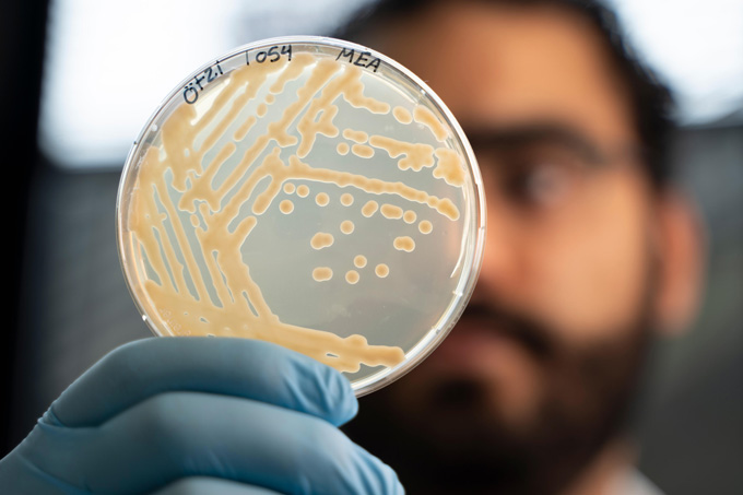 A petri dish of microbes grown from Otzi