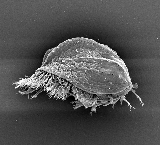 The underside of the protist Euplotes gigatrox showing many hairlike cilia surrounding an oval depression that is the organism's mouth.