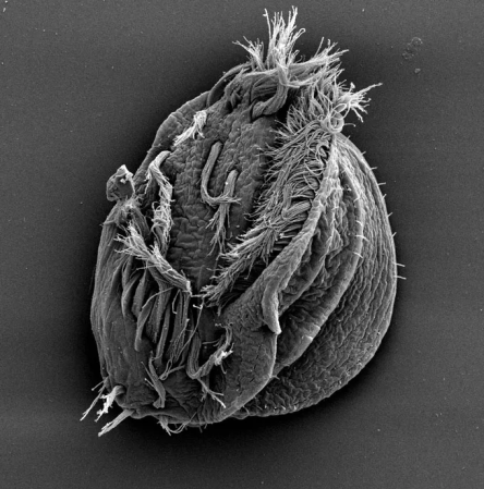 The underside of the protist Euplotes gigatrox showing many hairlike cilia surrounding an oval depression that is the organism's mouth.