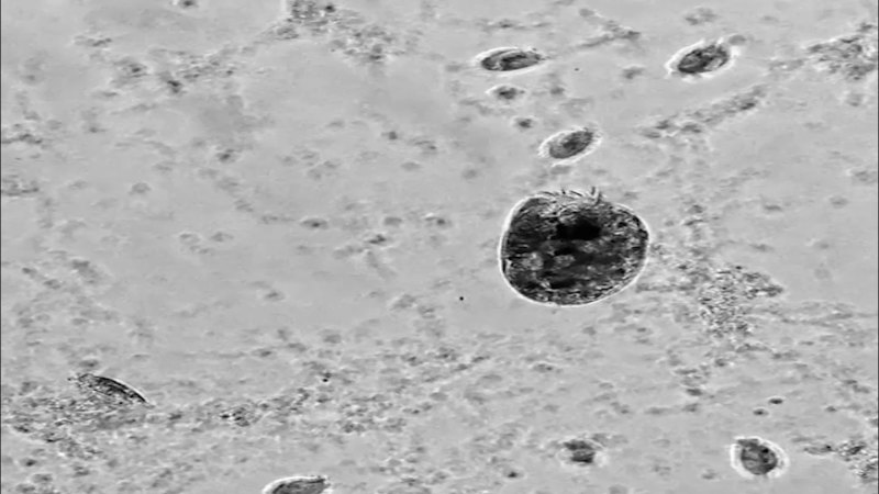 This microbe turns into a ‘Hulk’ that eats its own kind