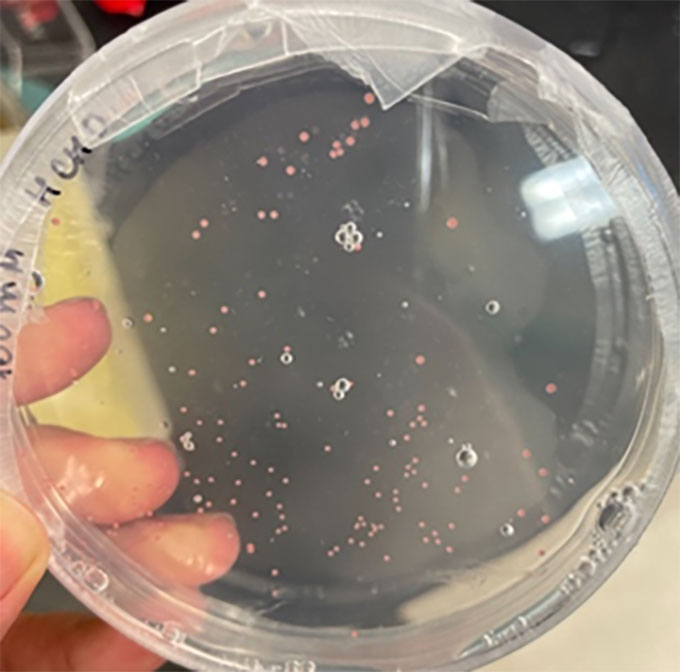 a petri plate showing some of the colonies of bacteria sampled from the fog