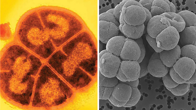 a composite image showing two different bacterium
