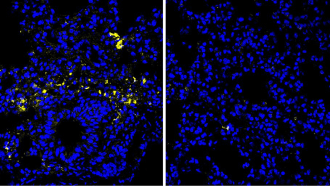 Microscopy images of lung tissue showing blue cell nuclei and yellow coronavirus in mice fed different amounts of arginine