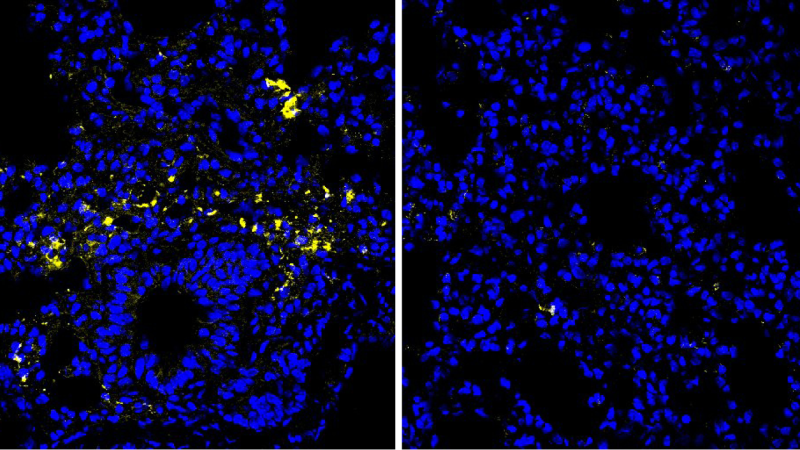 A protein building block may help fight viruses and cancer
